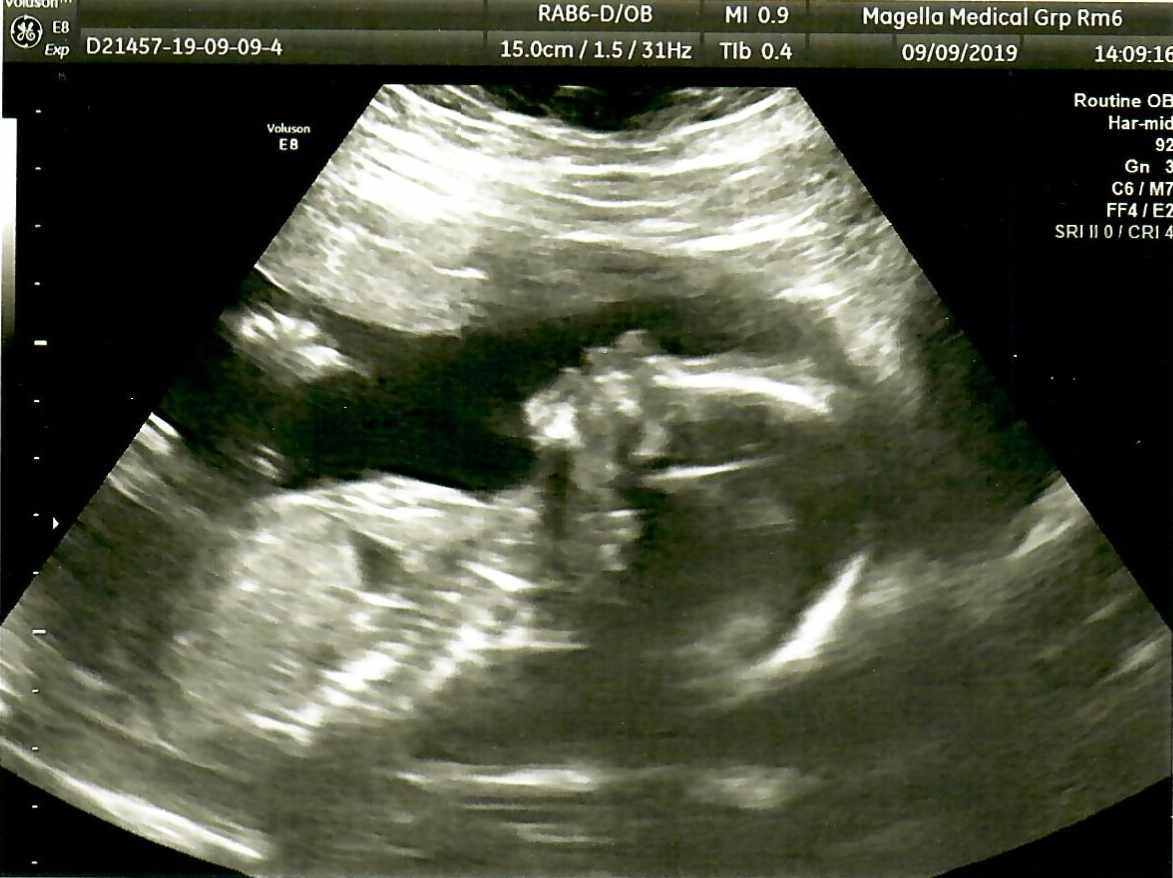 Millie's Ultrasound